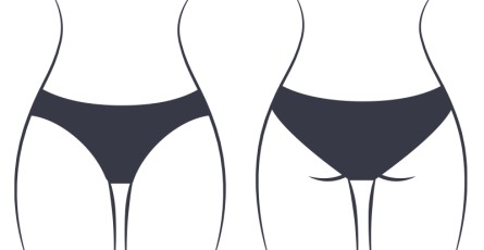 Figi